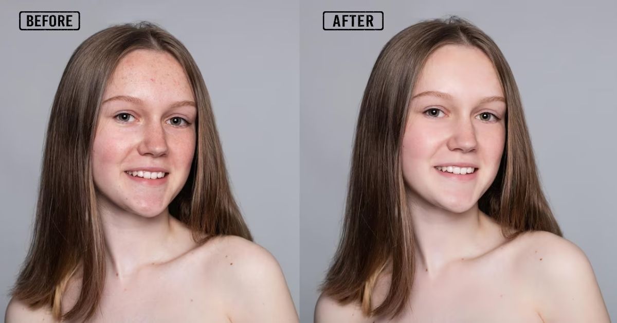 Fashion Photo Imperfections Removal